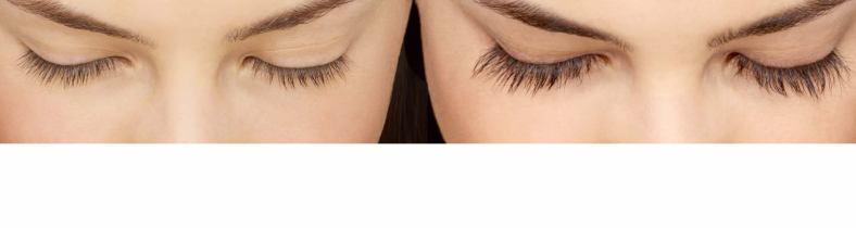 Before and After images of Latisse Treatment 