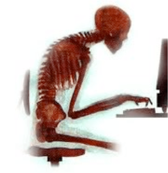 poor-posture